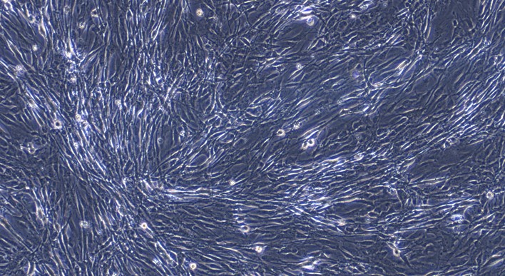 猫主动脉血管外膜成纤维细胞(AAF)原代细胞