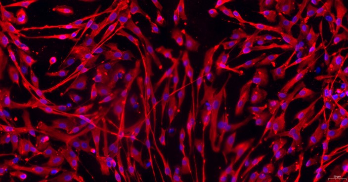 猫主动脉血管外膜成纤维细胞(AAF)原代细胞