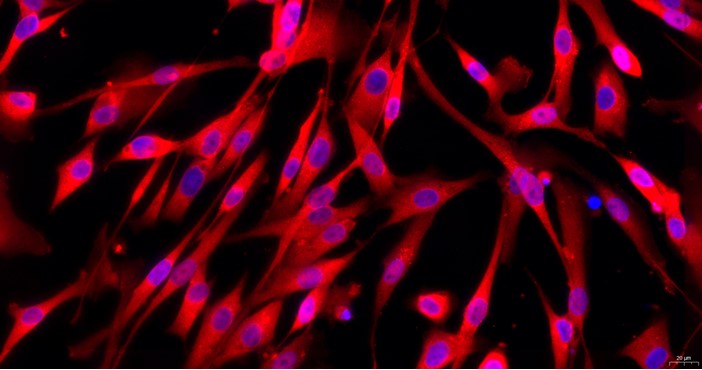 猫主动脉血管外膜成纤维细胞(AAF)原代细胞