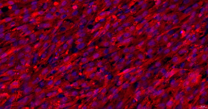 兔坐骨神经周围成纤维细胞( PSNC)原代细胞