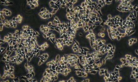 小鼠单核巨噬细胞白血病细胞（RAW264.7 ）