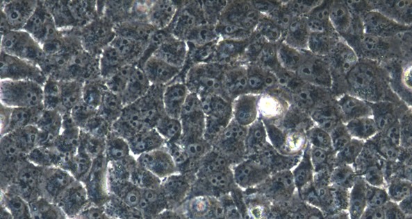 人PANC-1胰腺癌细胞(PANC-1)