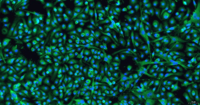 小鼠骨髓巨噬细胞(BMDM)原代细胞