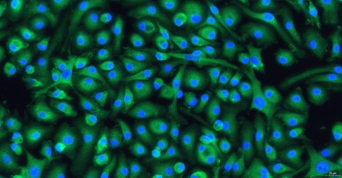 小鼠骨髓巨噬细胞(BMDM)原代细胞
