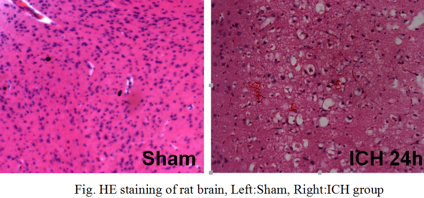 脑血肿(IH)大鼠模型