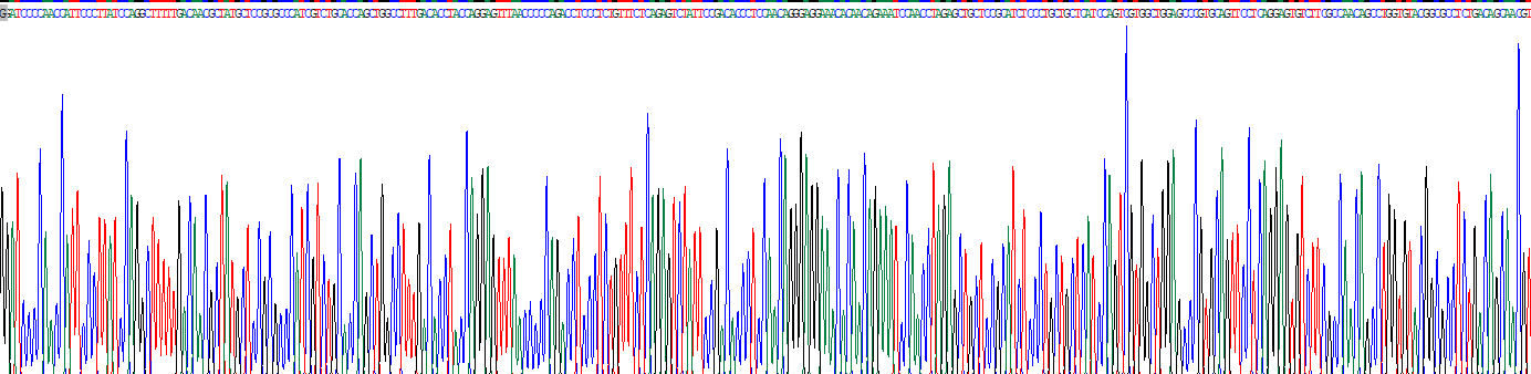 生长激素(GH)真核蛋白