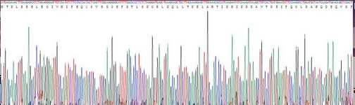 S100鈣結(jié)合蛋白A12(S100A12)真核蛋白