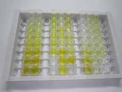 诱导型一氧化氮合酶(NOS2)检测试剂盒(酶联免疫吸附试验法,高敏型)