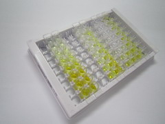 脂多糖结合蛋白(LBP)检测试剂盒(酶联免疫吸附试验法,高敏型)
