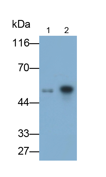 神經(jīng)膠質(zhì)纖維酸性蛋白(GFAP)多克隆抗體(異硫氰酸熒光素標記)
