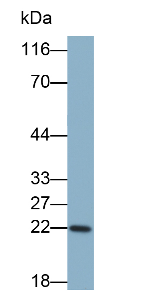 白介素1受体拮抗剂(IL1RA)多克隆抗体(生物素标记)