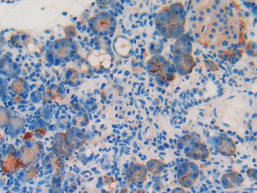 核糖核酸酶A(RNase A)多克隆抗体(生物素标记)