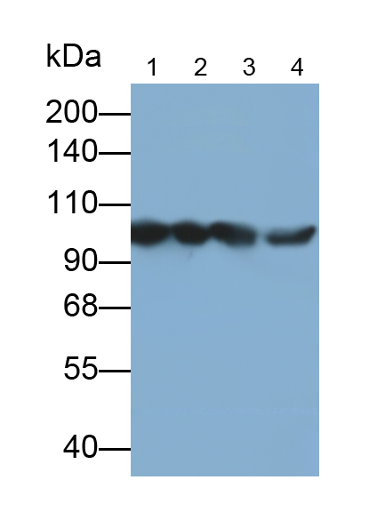 輔肌動(dòng)蛋白α2(ACTN2)多克隆抗體(異硫氰酸熒光素標(biāo)記)