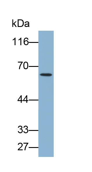 角蛋白5(CK5)多克隆抗體(生物素標記)