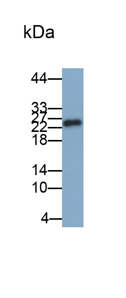 谷胱甘肽S转移酶μ1(GSTM1)多克隆抗体(生物素标记)