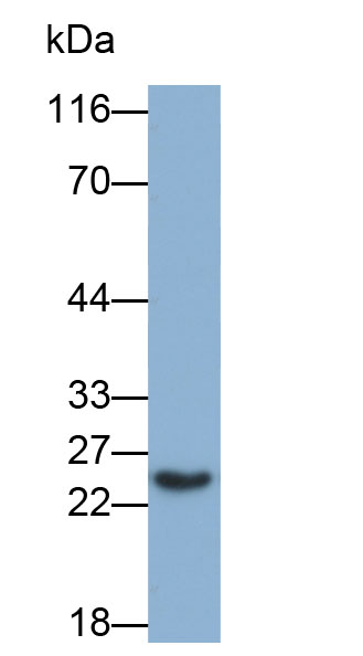 视黄醇结合蛋白4(RBP4)多克隆抗体(生物素标记)
