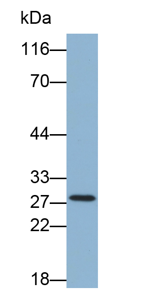 蛋白酶3(PR3)多克隆抗体(生物素标记)