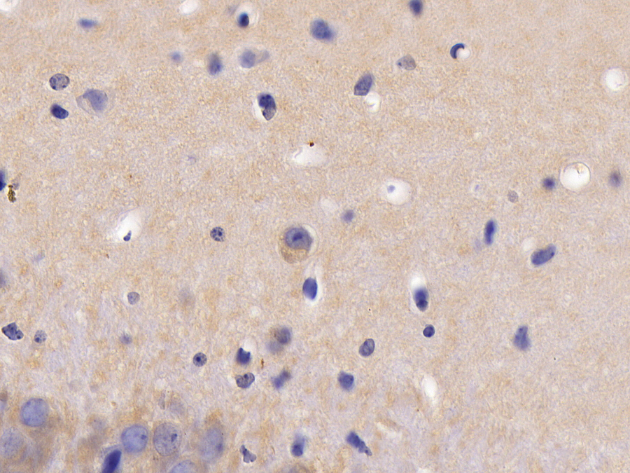 肿瘤坏死因子受体超家族成员1A(TNFR1)多克隆抗体(生物素标记)