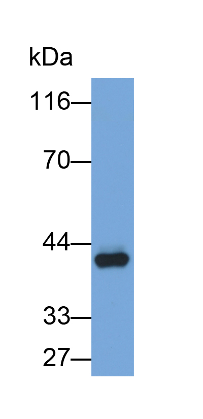 白介素2受体γ(IL2Rg)多克隆抗体(生物素标记)