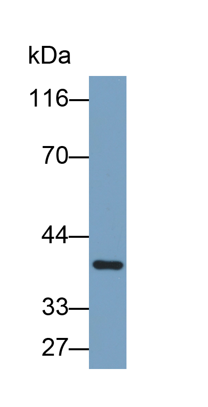 白介素13受体α2(IL13Ra2)多克隆抗体(生物素标记)