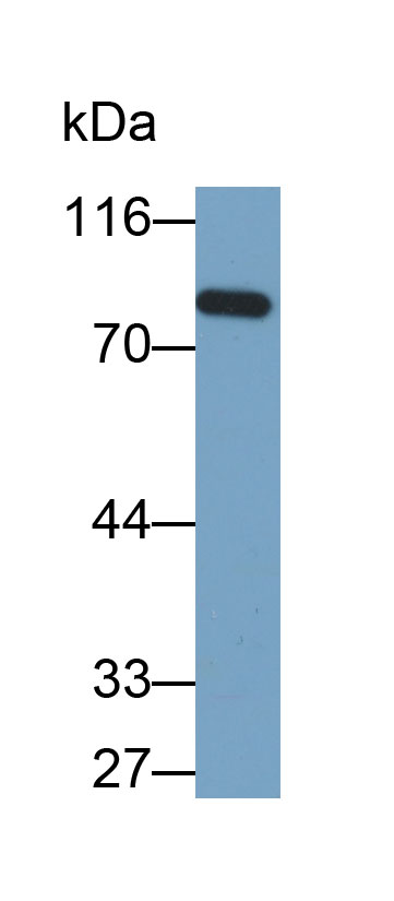 谷氨酰胺轉(zhuǎn)胺酶2(TGM2)多克隆抗體(生物素標(biāo)記)