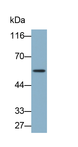 醛脫氫酶7家族成員A1(ALDH7A1)多克隆抗體(生物素標(biāo)記)