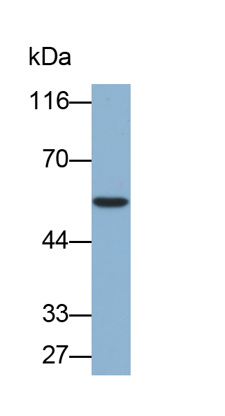 醛脫氫酶7家族成員A1(ALDH7A1)多克隆抗體(生物素標(biāo)記)