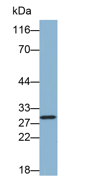 氯化物細(xì)胞內(nèi)通道蛋白4(CLIC4)多克隆抗體(生物素標(biāo)記)