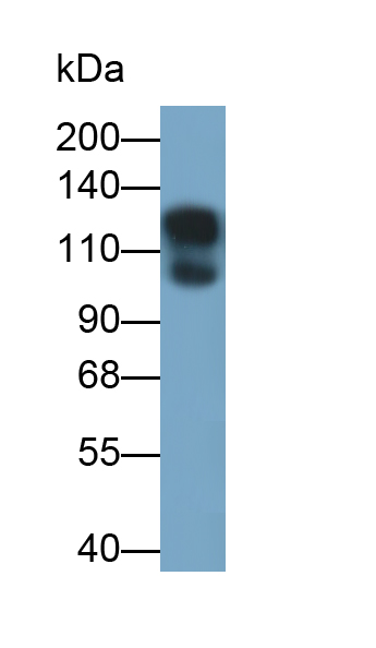上皮性鈣黏附蛋白單克隆抗體