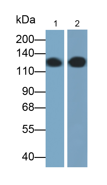 上皮性鈣黏附蛋白單克隆抗體