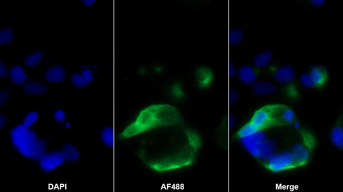 上皮性鈣黏附蛋白單克隆抗體