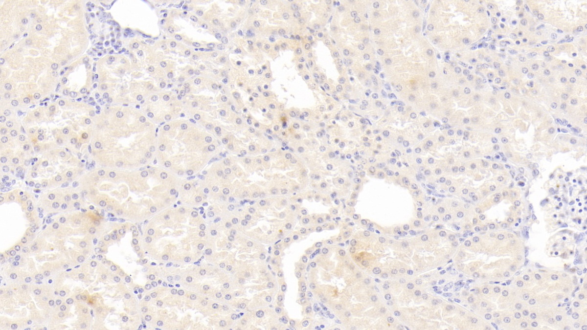 白介素12B(IL12B)單克隆抗體
