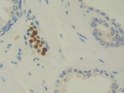 白介素12A(IL12A)單克隆抗體