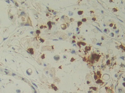 白介素12A(IL12A)單克隆抗體