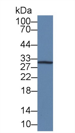 白介素12A(IL12A)單克隆抗體