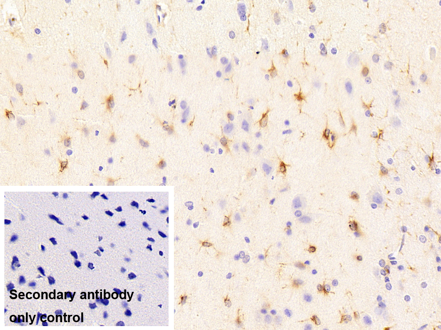 神經(jīng)膠質(zhì)纖維酸性蛋白(GFAP)單克隆抗體