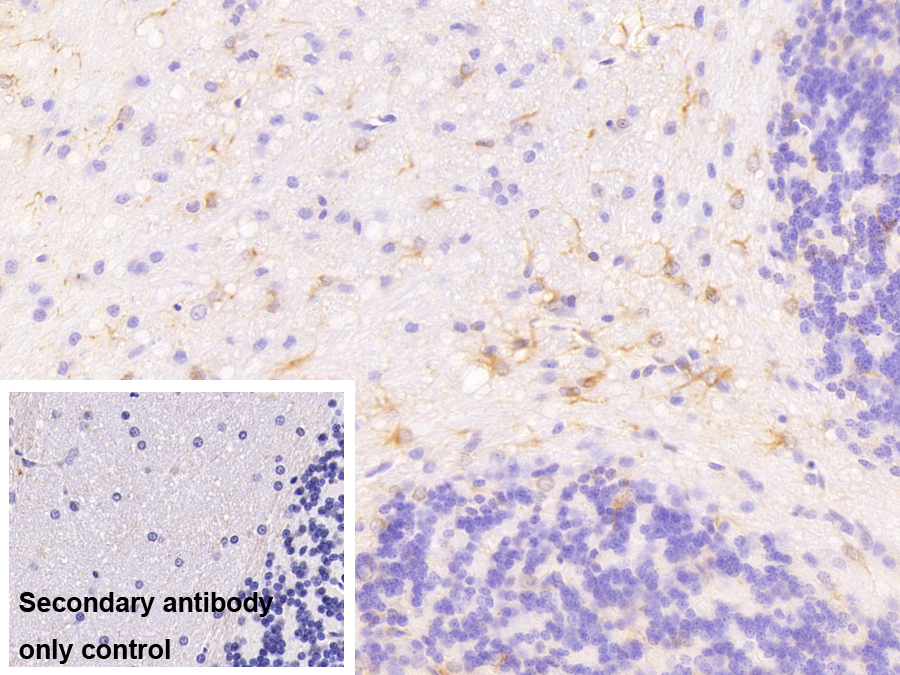 神經(jīng)膠質(zhì)纖維酸性蛋白(GFAP)單克隆抗體