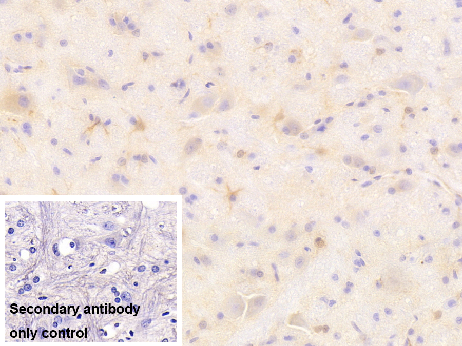 神經(jīng)膠質(zhì)纖維酸性蛋白(GFAP)單克隆抗體