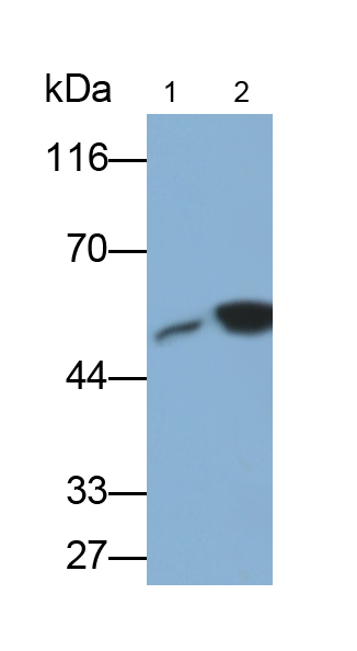神經(jīng)膠質(zhì)纖維酸性蛋白(GFAP)單克隆抗體