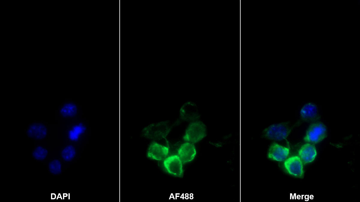 白介素1α(IL1a)单克隆抗体