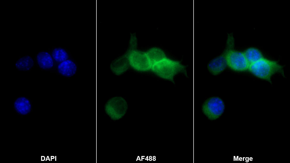 白介素1α(IL1a)单克隆抗体
