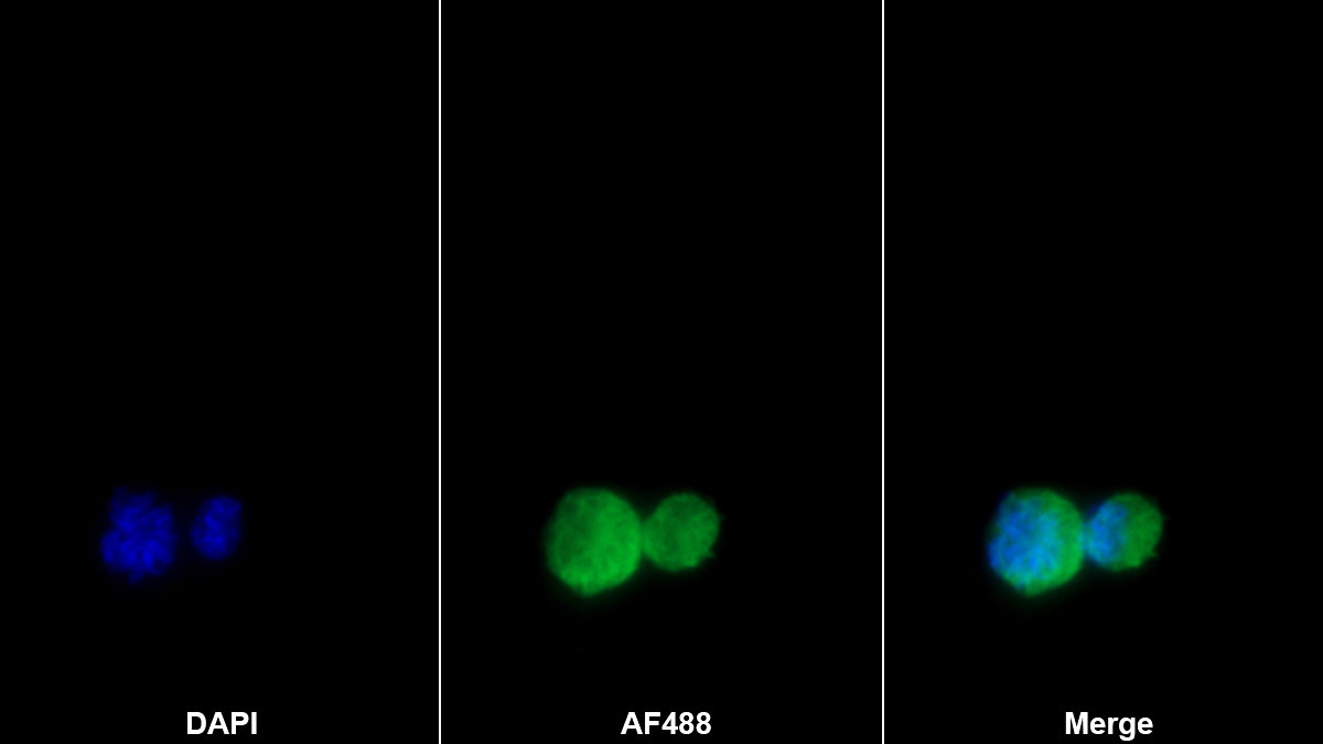 白介素1α(IL1a)单克隆抗体