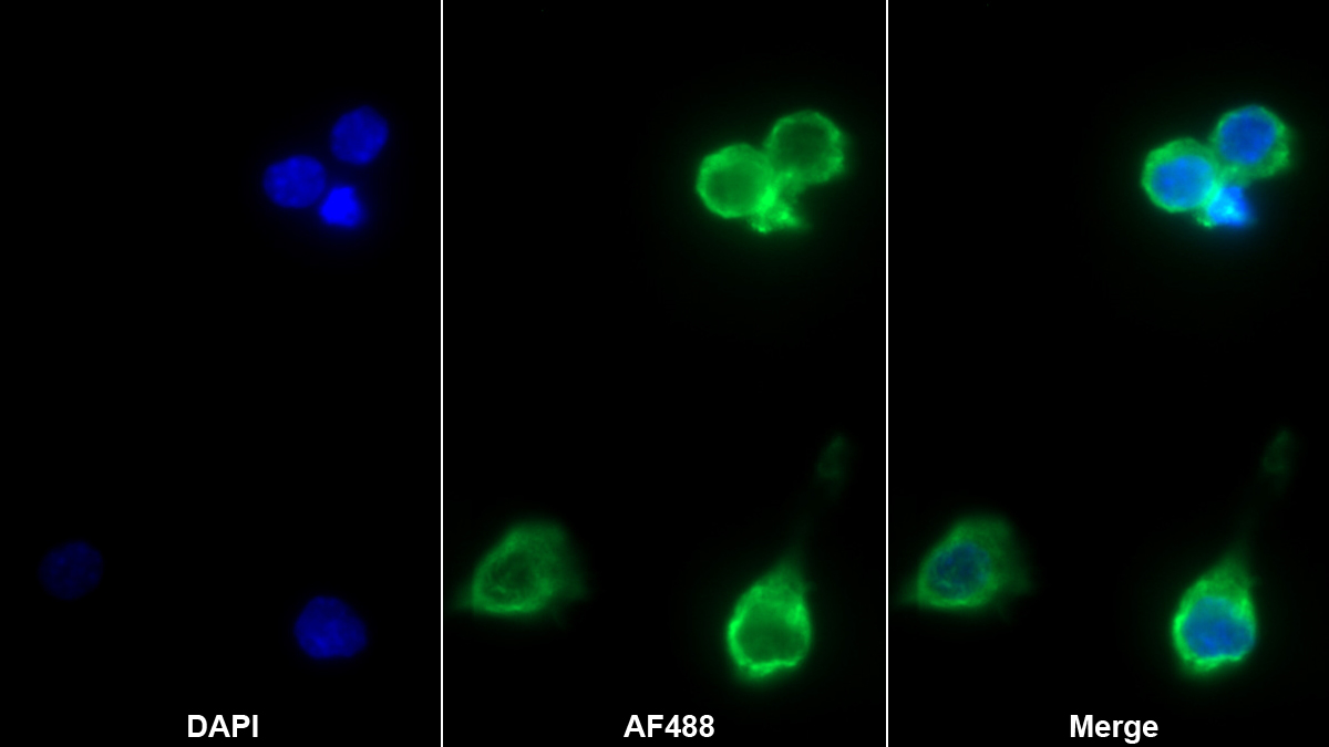 白介素1α(IL1a)单克隆抗体