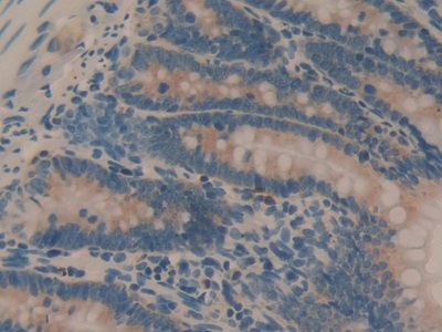 白介素1α(IL1a)单克隆抗体
