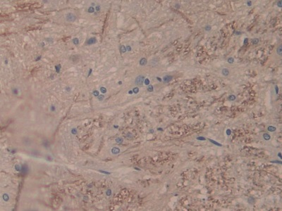 白介素1α(IL1a)单克隆抗体