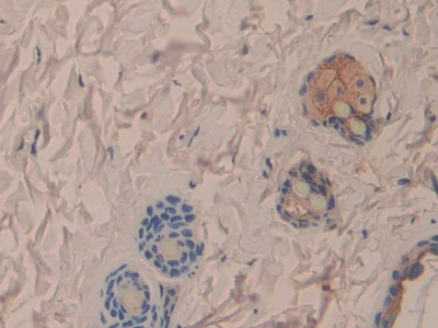白介素1α(IL1a)单克隆抗体