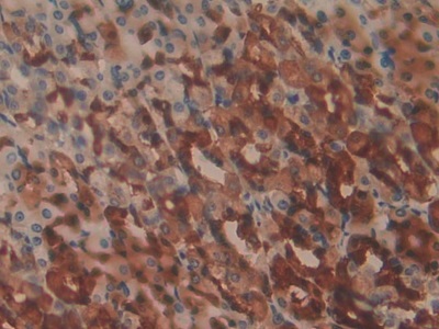 白介素1α(IL1a)单克隆抗体