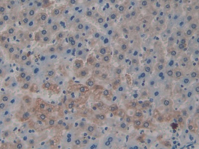白介素1α(IL1a)单克隆抗体