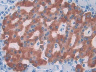 白介素1α(IL1a)单克隆抗体
