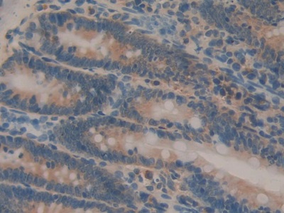 白介素1α(IL1a)单克隆抗体